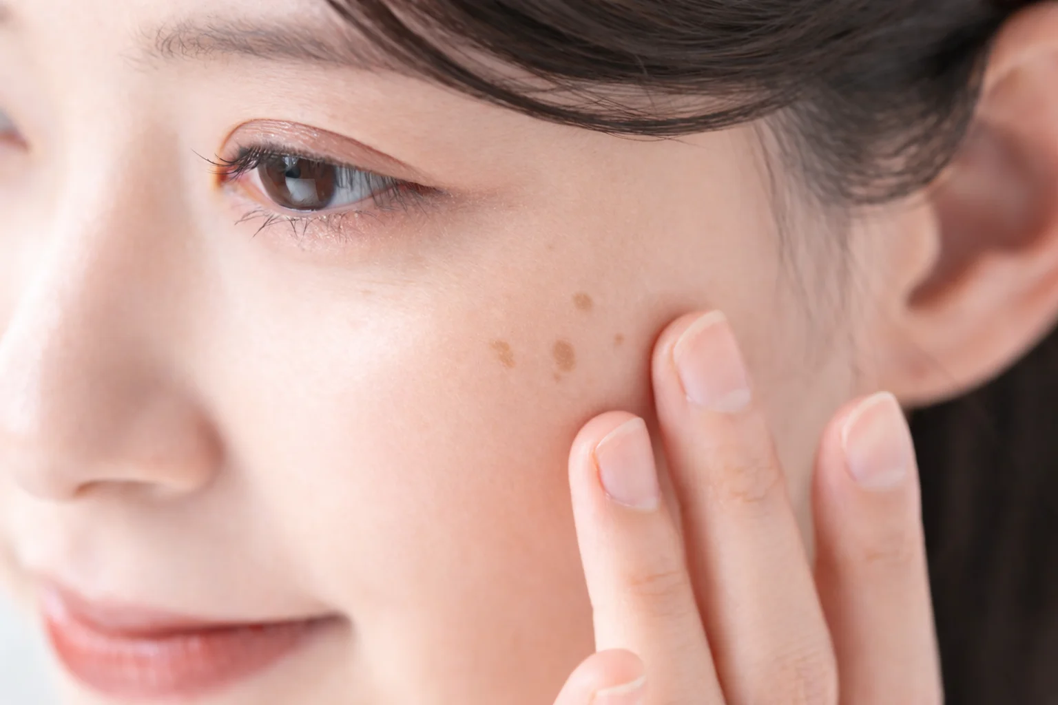 Lentigo and blemish treatment model